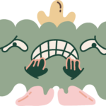 Worried